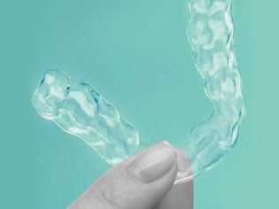 Teeth straightening Teeth straightening